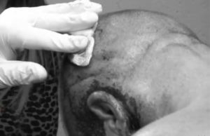 Triple H Receives Staples In His Scalp After RAW (Video), WWE Ref Injured