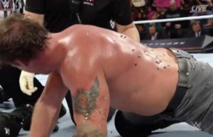 Graphic Video Of Jericho Having Tacks Removed After Extreme Rules, More