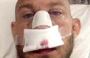 Ryback Shares Post-Surgery Photos & Takes Another Dig At CM Punk