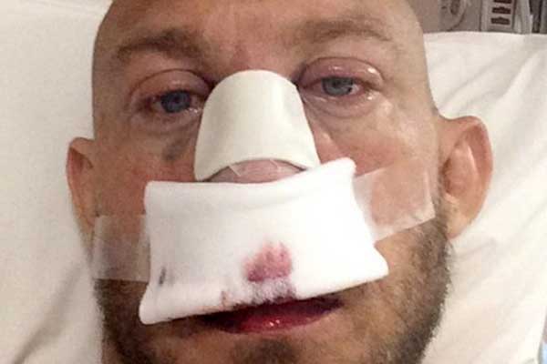 Ryback Shares Post-Surgery Photos & Takes Another Dig At CM Punk