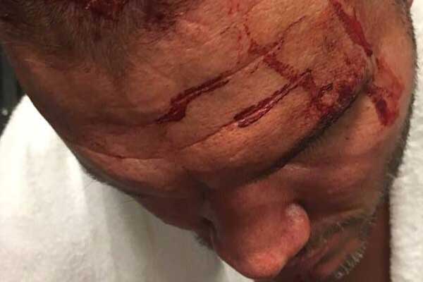 Report: Orton Didn’t Know About Elbow Finish Until The Night Of SummerSlam