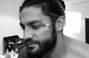 Roman Reigns Receives Stitches After #WWEMelbourne (Photo)