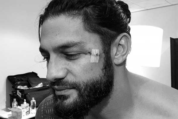 Roman Reigns Receives Stitches After #WWEMelbourne (Photo)