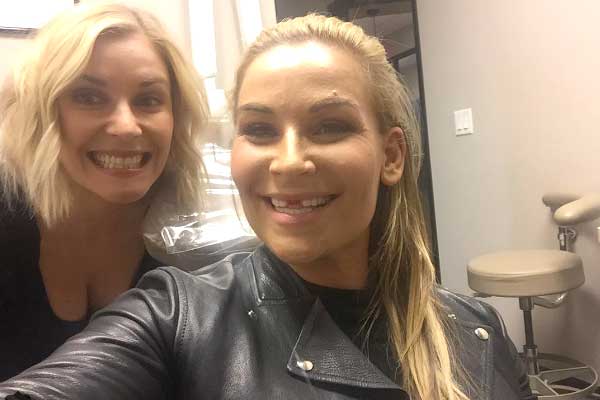 Natalya’s Front Teeth Knocked Out (Photos)