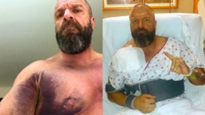 Triple H Undergoes Surgery For Pectoral Tear