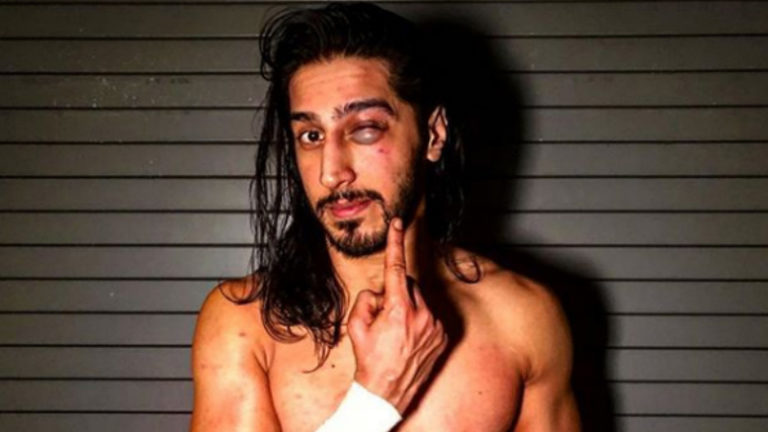 Mustafa Ali Gets Black Eye From Match With Randy Orton