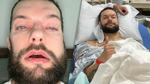 Finn Balor Provides Update Days After Jaw Surgery