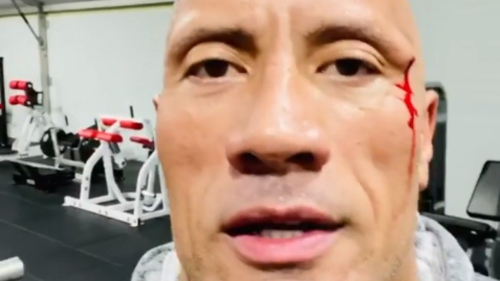 The Rock Gets Busted Open While Working Out (Video)