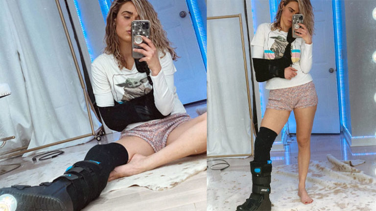 Lana Posts Photos Wearing A Sling & Leg Brace: “Piss Off 2020”