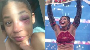 Pics: Bianca Belair’s Swollen Eye Following WrestleMania 38 Win