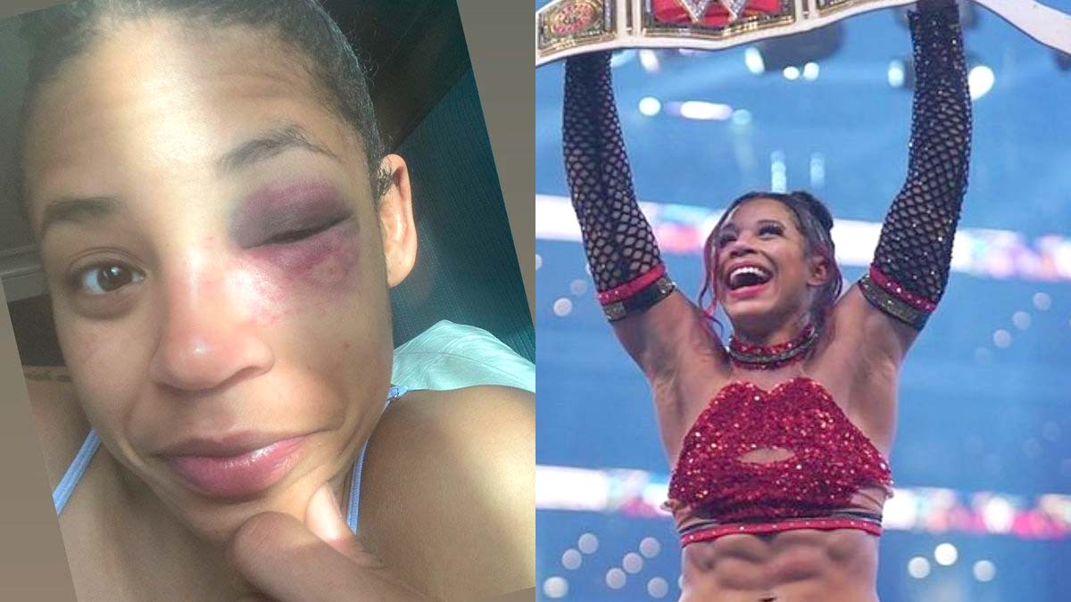 Pics: Bianca Belair’s Swollen Eye Following WrestleMania 38 Win