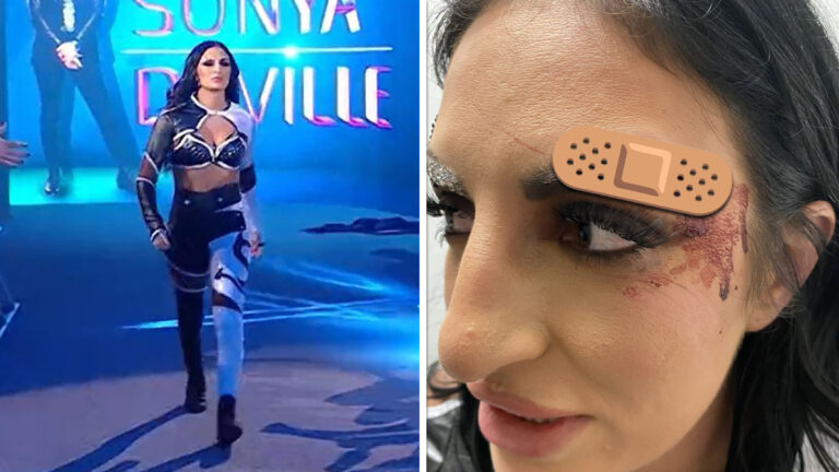 Sonya Deville Shows Off Nasty Injury from the Royal Rumble: “I’m a Beast!”