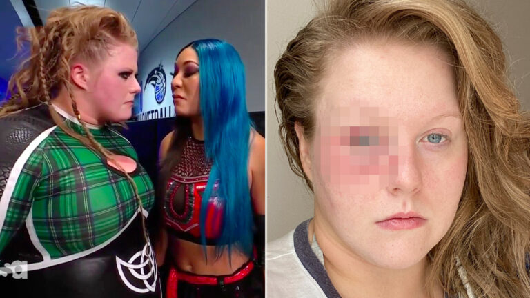 Piper Niven’s Eye Banged Up  During Backstage Attack on WWE Raw