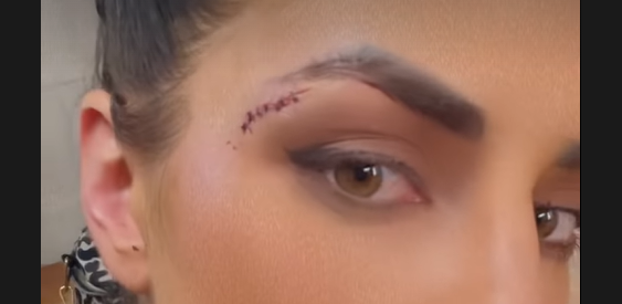 Sonya Deville Suffers Facial Injury at WWE Pensacola Live Event