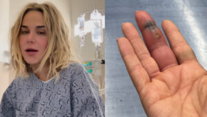 CJ Perry Reveals What Led To Her Finger Infection That Required Surgery