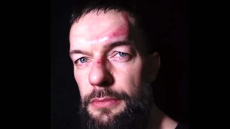 Finn Balor Shows Off Gruesome Forehead Injury Ahead of WrestleMania 40