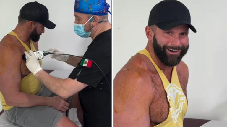 Matt Cardona is The Latest Wrestler Using Stem Cell Therapy To Deal with Injuries