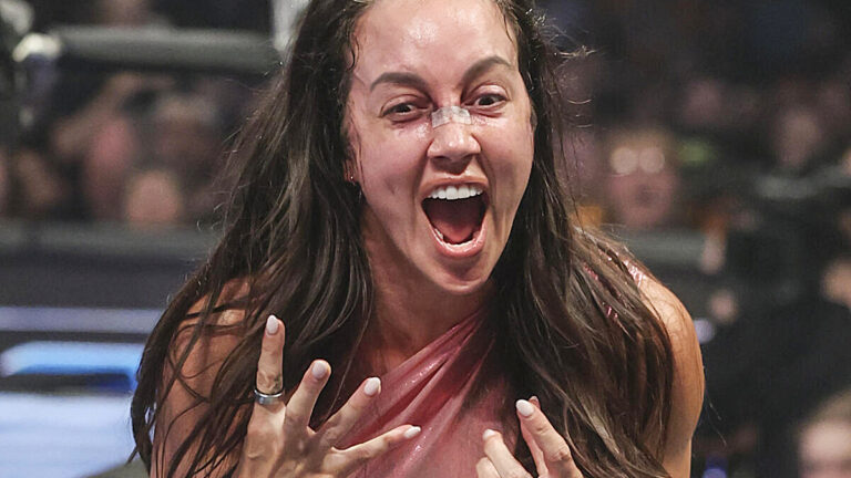 Chelsea Green Denies Broken Nose Injury Despite Face Mask