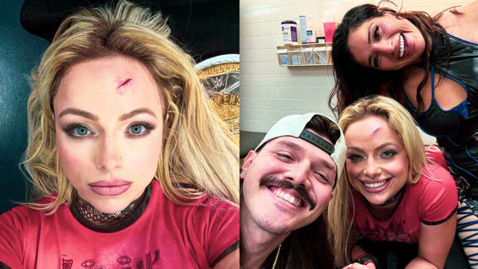 Liv Morgan Head Wound