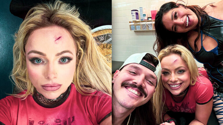Liv Morgan Displays Battle Scars Following Money in the Bank Qualifier