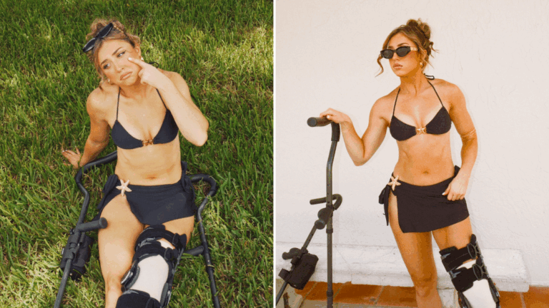 Adriana Rizzo Tells All On How Torn ACL Happened