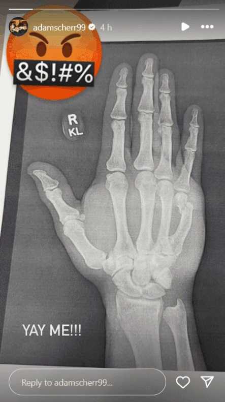 strowman wrist