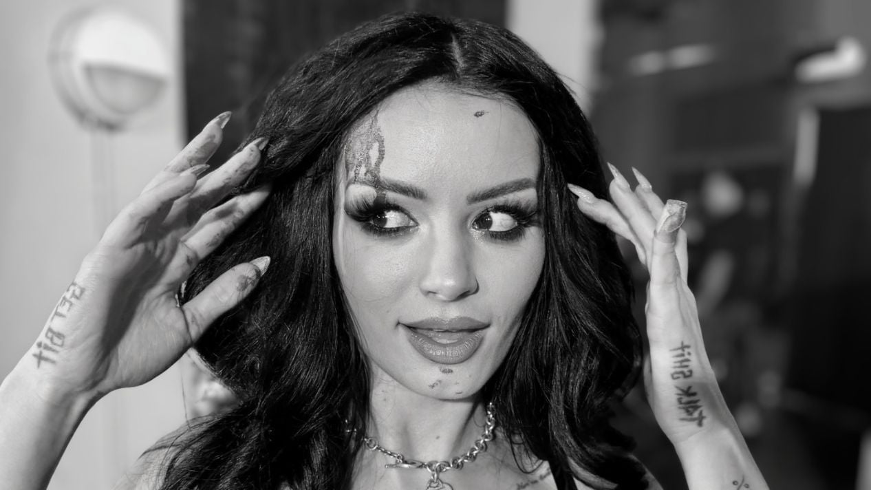 Paige Busted Open, Needed Stitches After Nia Jax Attack on SmackDown