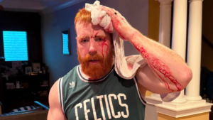 Sheamus Shares Photos Of Head Wound Suffered In Gym Accident