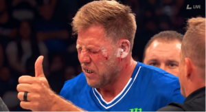 Jake Hager gives a thumbs-up while bleeding from his eye after his Power Slap 23 loss to Johnny Magna
