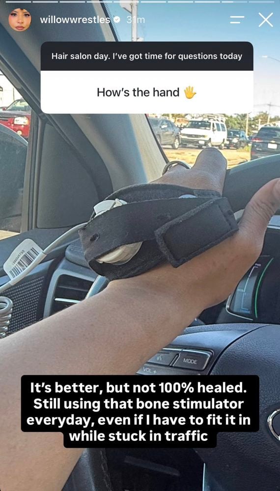 Willow Nightingale Instagram story showing a bone stimulator on her injured hand